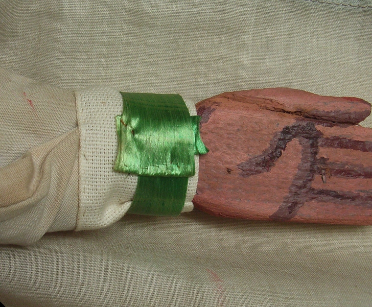 Polso sinistro dopo il restauro